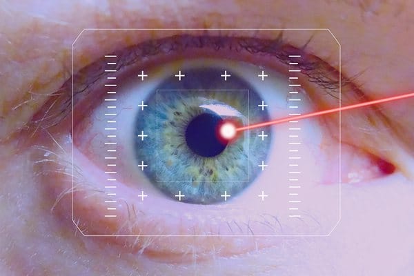 新西兰可以做近视眼激光手术吗？