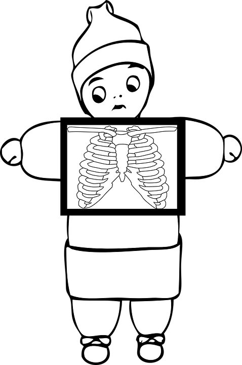 immigration-chest-x-ray-expiration