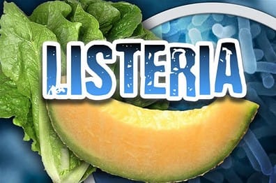 new-zealand-listeria